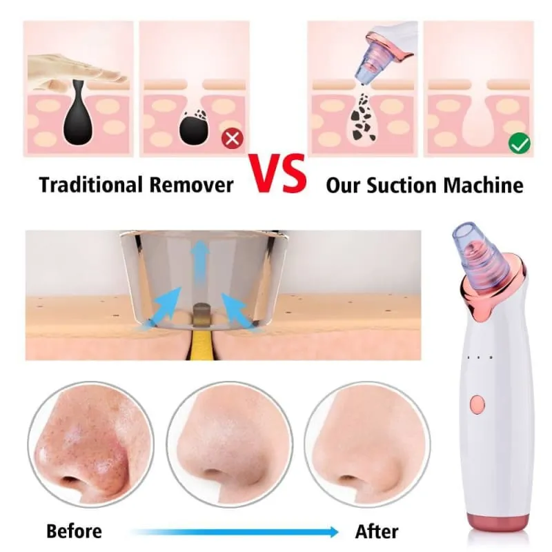 Electric Blackhead Remover Nose Cleaner